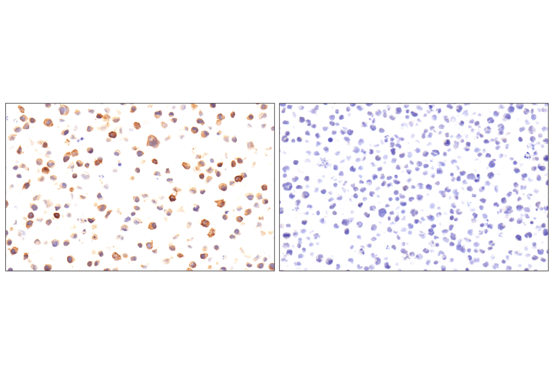 Immunohistochemistry Image 8: SLC40A1/Ferroportin-1 (F9U5S) Rabbit Monoclonal Antibody (BSA and Azide Free)