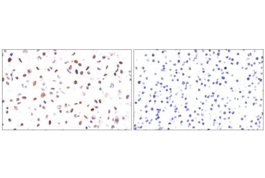 Immunohistochemistry Image 10: HIF-1 alpha (E1V6A) Rabbit Monoclonal Antibody (BSA and Azide Free)
