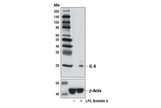 Western Blotting Image 2: IL-6 (D3K2N) Rabbit Monoclonal Antibody