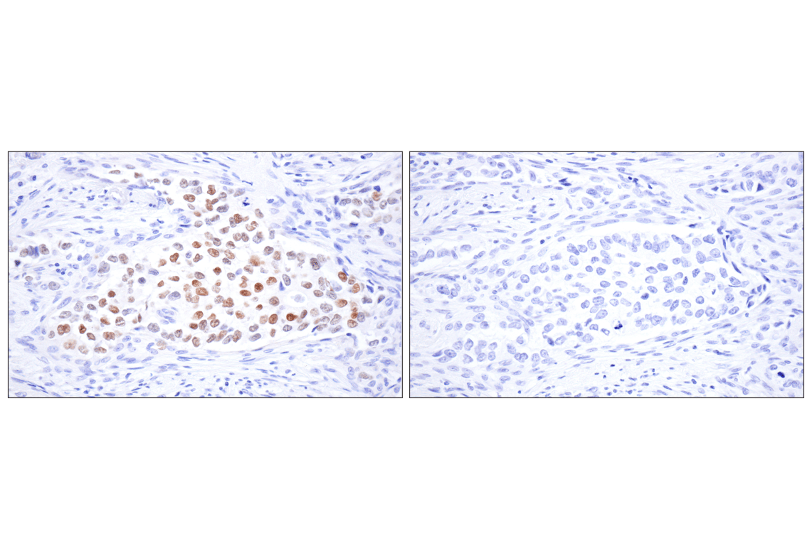 Immunohistochemistry Image 1: Estrogen Receptor alpha (D8H8) Rabbit Monoclonal Antibody