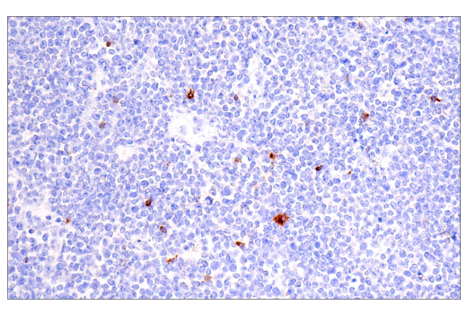 Immunohistochemistry Image 6: CTLA-4 (E2V1Z) Rabbit mAb (BSA and Azide Free)