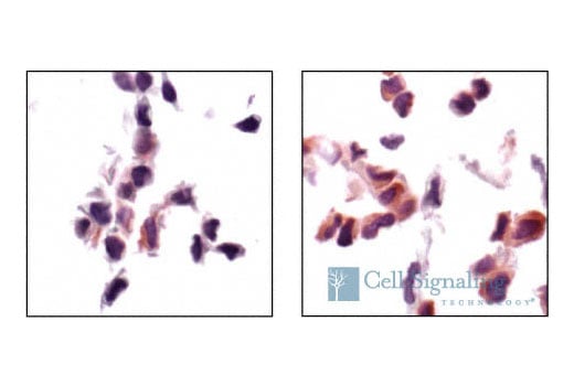 Immunohistochemistry Image 2: Phospho-Acetyl-CoA Carboxylase (Ser79) Antibody