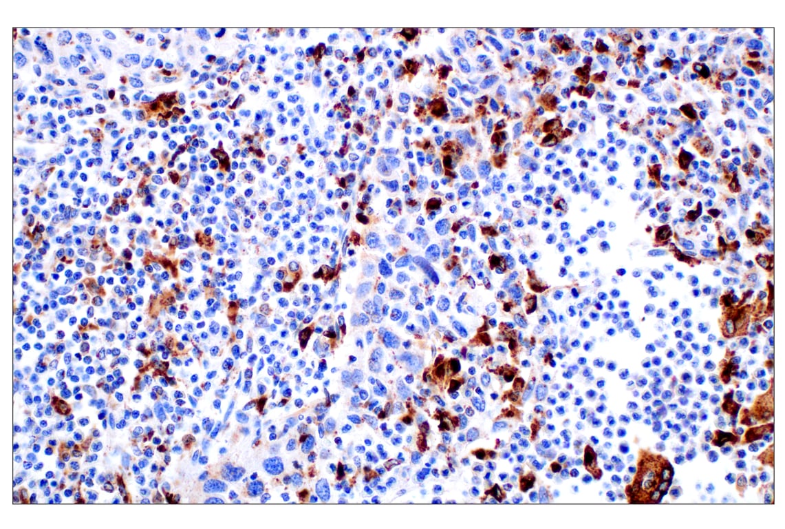 undefined Image 12: Genetics of Parkinson's Disease: Lysosomal Dysfunction Antibody Sampler Kit