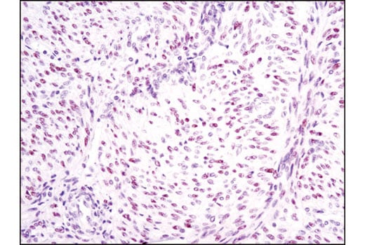 Immunohistochemistry Image 3: HMGA2 (D1A7) Rabbit Monoclonal Antibody