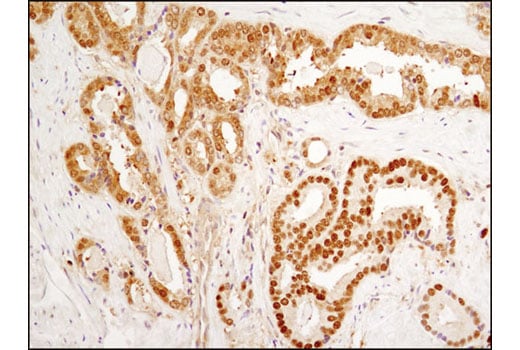 undefined Image 14: Forkhead Signaling Antibody Sampler Kit