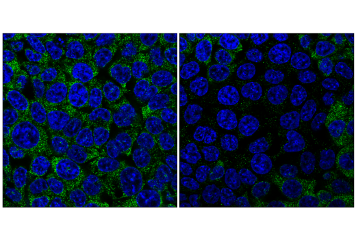 Immunofluorescence Image 1: YTHDF1 (E8R5L) Rabbit Monoclonal Antibody