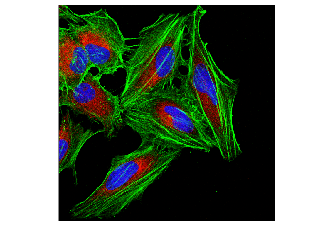 Immunofluorescence Image 1: beta-Actin (E4D9Z) Mouse Monoclonal Antibody