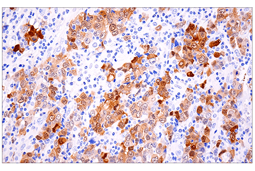 Immunohistochemistry Image 4: Calretinin (E7R6O) Rabbit Monoclonal Antibody