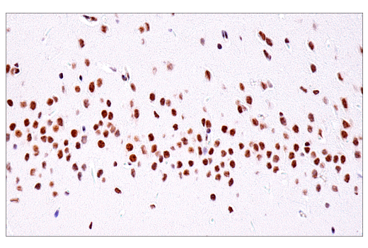 Immunohistochemistry Image 15: USP39 (E8U2M) Rabbit Monoclonal Antibody