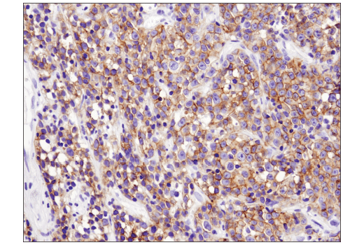 Immunohistochemistry Image 1: CXCR5 (D6L3C) Rabbit Monoclonal Antibody