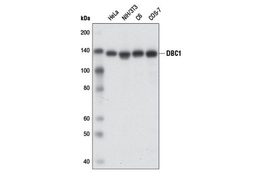 Western Blotting Image 1: DBC1 (3G4) Mouse mAb