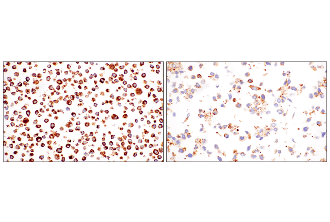 Immunohistochemistry Image 12: HEXB (E9X5S) Rabbit Monoclonal Antibody (BSA and Azide Free)