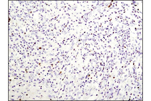 Immunohistochemistry Image 1: T-bet/TBX21 (D6N8B) Rabbit Monoclonal Antibody