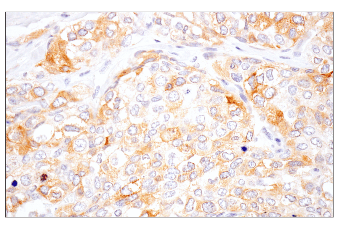 Immunohistochemistry Image 3: Eg5 (E1L3W) Rabbit Monoclonal Antibody