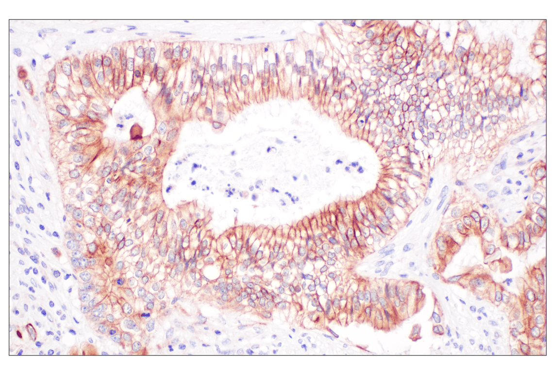 Immunohistochemistry Image 3: Desmoplakin (F3J8Y) Rabbit Monoclonal Antibody