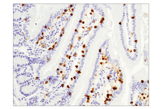 Immunohistochemistry Image 2: CD8α (D4W2Z) XP<sup>®</sup> Rabbit mAb (BSA and Azide Free)