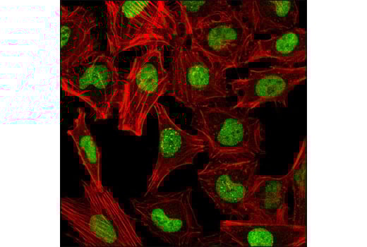Immunofluorescence Image 1: CHAF1A (D77D5) Rabbit Monoclonal Antibody
