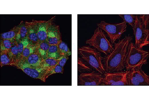 Immunofluorescence Image 1: C-Peptide Antibody