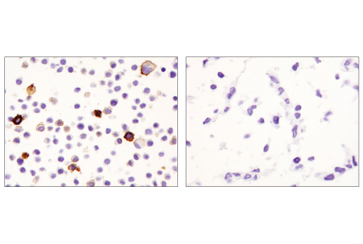 Immunohistochemistry Image 5: CD11c (D1V9Y) Rabbit Monoclonal Antibody (BSA and Azide Free)