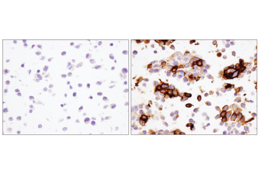 Immunohistochemistry Image 5: PD-1 (Intracellular Domain) (D4W2J) XP<sup>®</sup> Rabbit mAb (BSA and Azide Free)