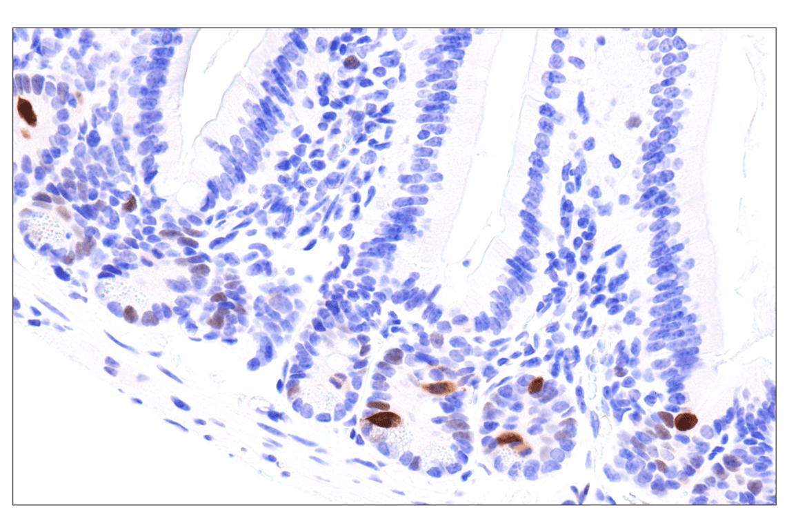 Phospho-NPM1 (Thr199) (E4C7S) Rabbit mAb (BSA and Azide Free