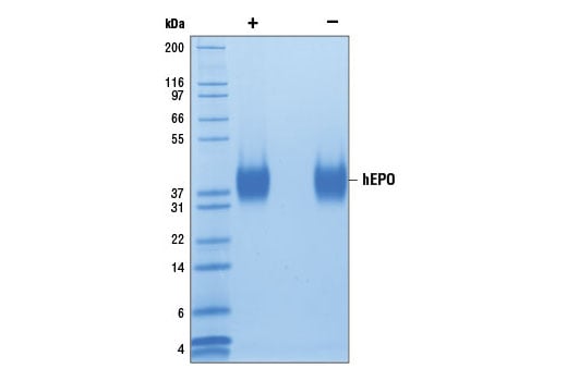 undefined Image 2: Human Erythropoietin (hEPO)
