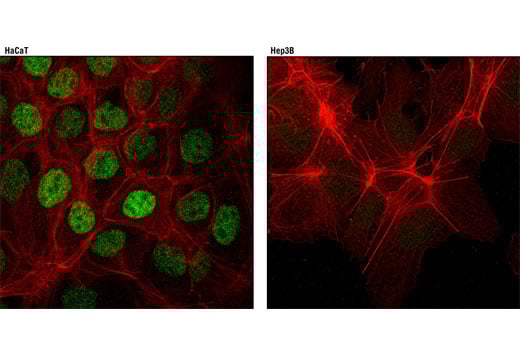 Immunofluorescence Image 1: RAR gamma1 (D3A4) Rabbit Monoclonal Antibody