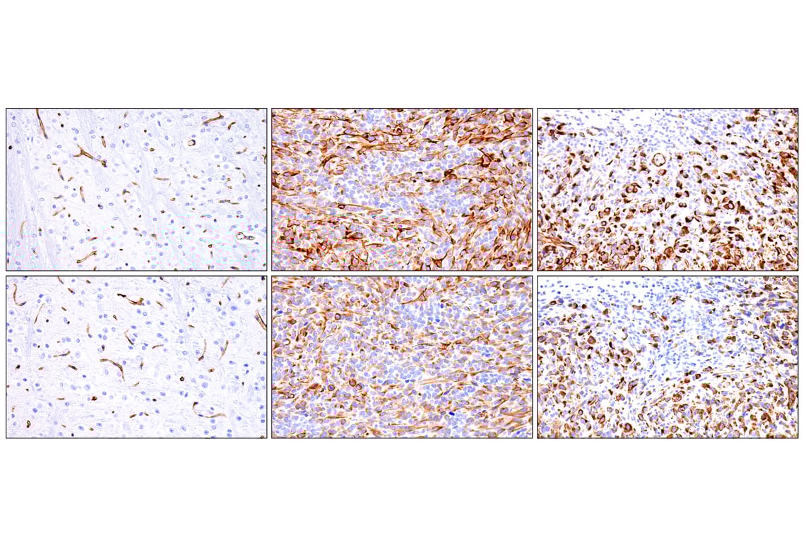 Immunohistochemistry Image 12: Nestin (E5C7I) Rabbit Monoclonal Antibody (BSA and Azide Free)