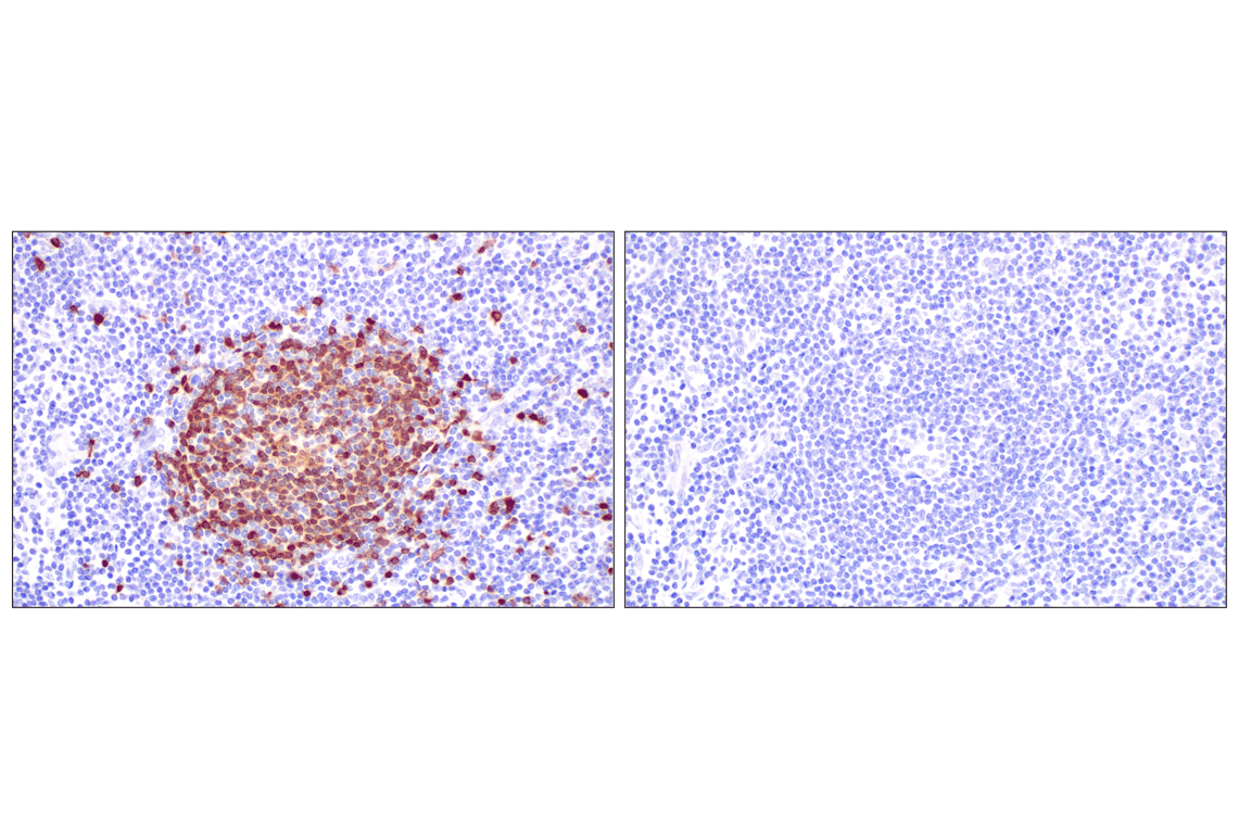 Immunohistochemistry Image 7: TCL1 (F9R1X) Rabbit Monoclonal Antibody