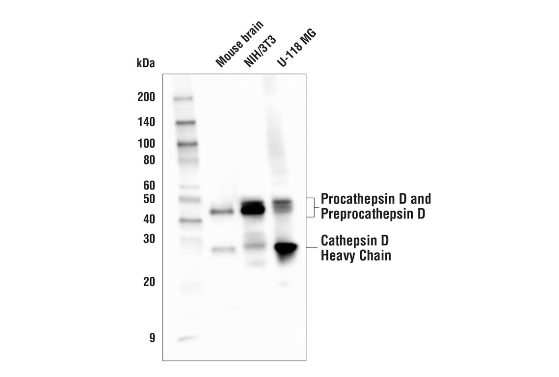 Western Blotting Image 1: Cathepsin D (E179) Antibody