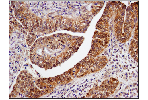 Immunohistochemistry Image 1: SMAD4 (D3R4N) Rabbit Monoclonal Antibody