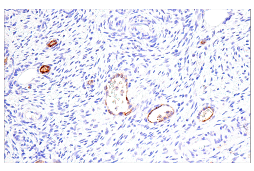 Immunohistochemistry Image 7: DPEP-1/MDP (E4O6J) Rabbit Monoclonal Antibody (BSA and Azide Free)