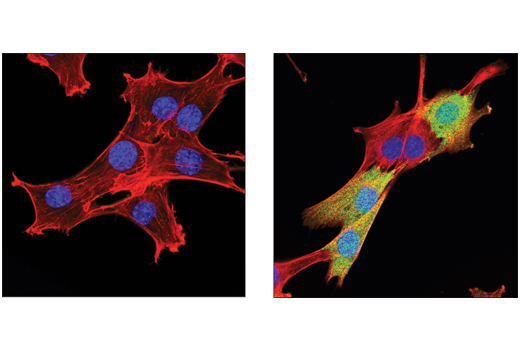 Immunofluorescence Image 1: IDO (D8W5E) Rabbit Monoclonal Antibody