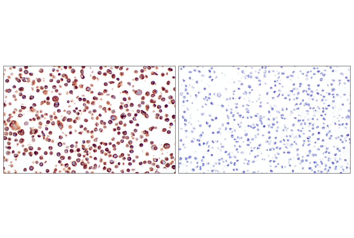 Immunohistochemistry Image 9: TMEM106B (E7H7Z) Rabbit Monoclonal Antibody