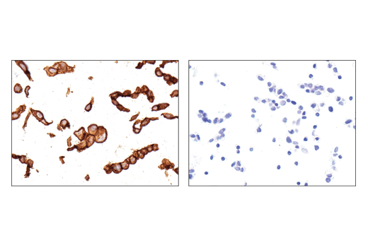 Immunohistochemistry Image 1: CD47 (D3O7P) Rabbit Monoclonal Antibody
