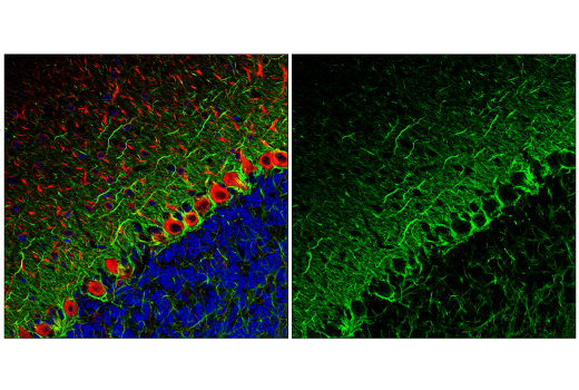 Immunofluorescence Image 2: Neurofilament-M (E7L2T) Rabbit Monoclonal Antibody