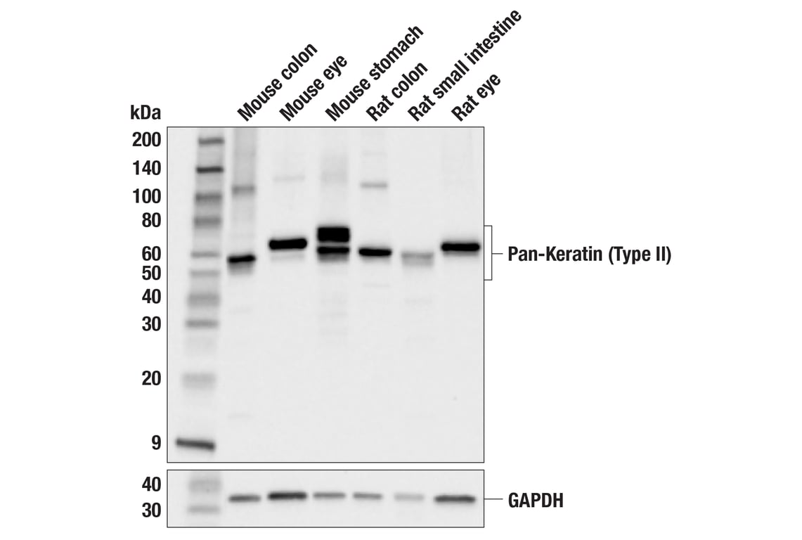 Western Blotting Image 3: Pan-Keratin (Type II) (F6G1P) Rabbit Monoclonal Antibody