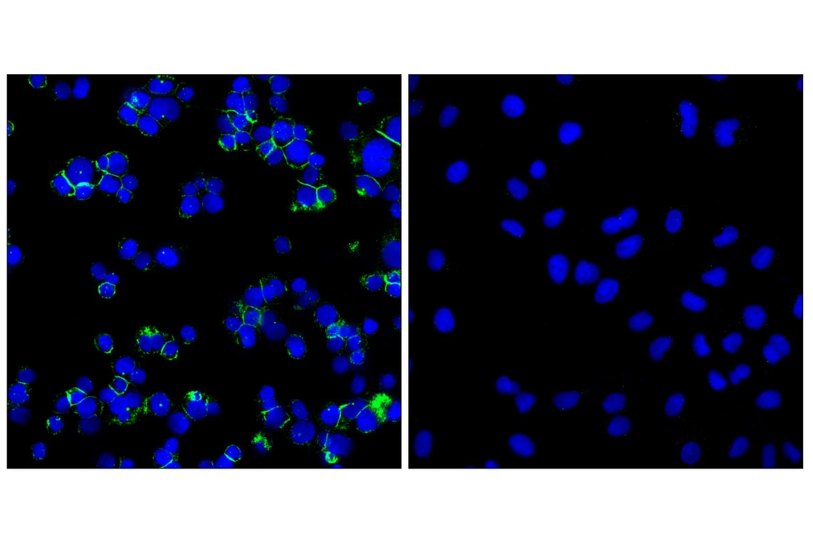 Immunofluorescence Image 1: CD11b/ITGAM (E3J2F) Rabbit Monoclonal Antibody