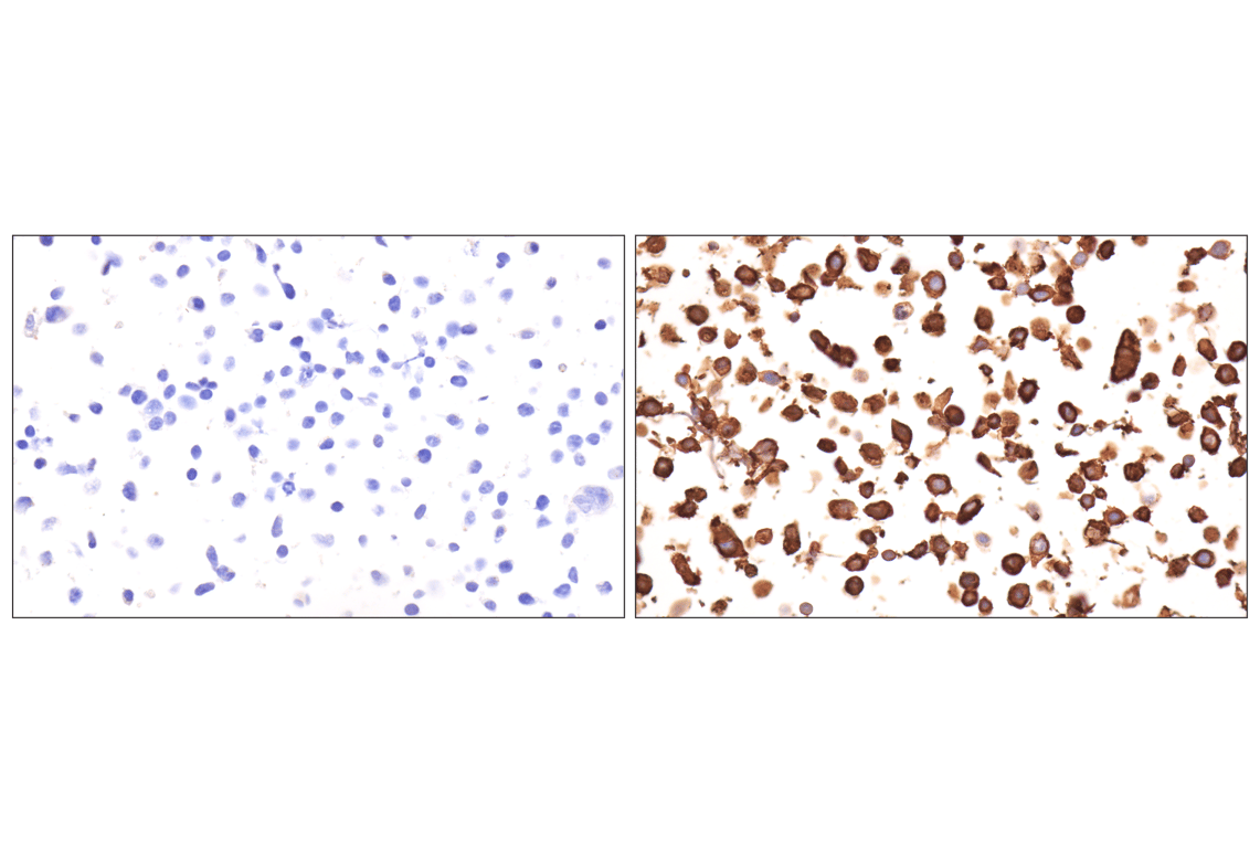 Immunohistochemistry Image 19: CD177 (F9O5U) Rabbit Monoclonal Antibody (BSA and Azide Free)