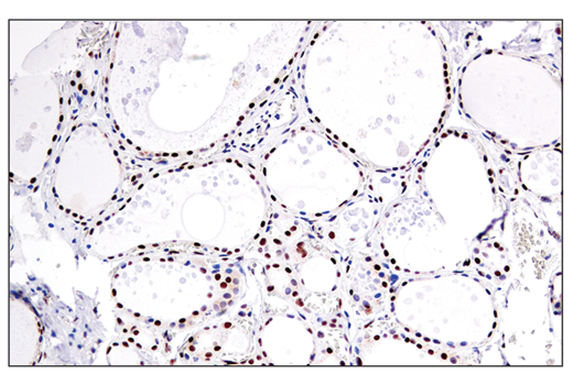 Immunohistochemistry Image 3: RAI17/ZMIZ1 (E2X3X) Rabbit Monoclonal Antibody
