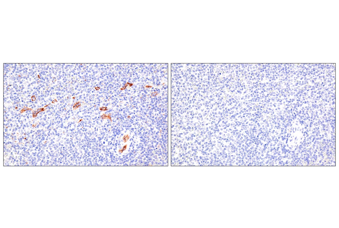 Immunohistochemistry Image 8: Claudin-5 (E5D9Y) Rabbit Monoclonal Antibody (BSA and Azide Free)