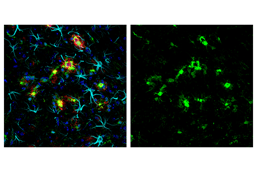 Immunofluorescence Image 1: Iba1/AIF-1 (E4O4W) Rabbit Monoclonal Antibody (Alexa Fluor<sup>®</sup> 488 Conjugate)
