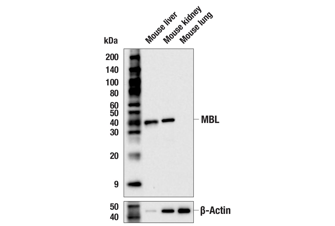 Western Blotting Image 2: MBL (E2F7B) Rabbit Monoclonal Antibody