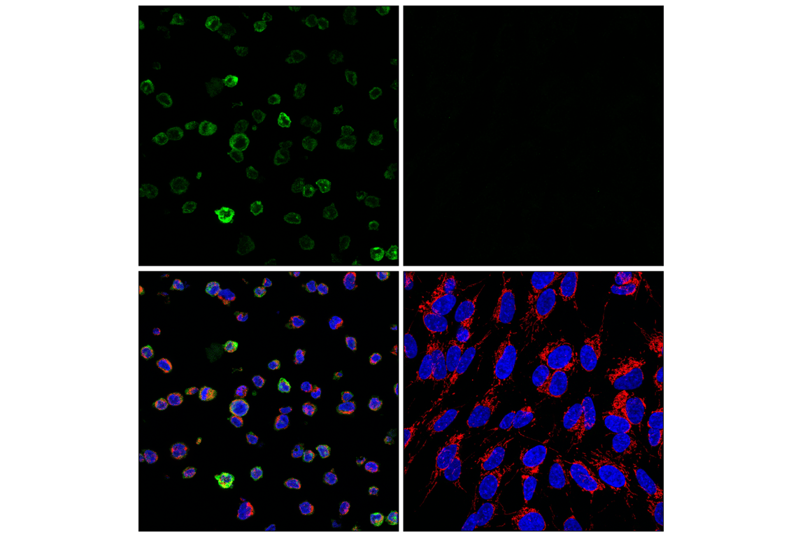 Immunofluorescence Image 1: TREM2 (E4F5G) Mouse Monoclonal Antibody