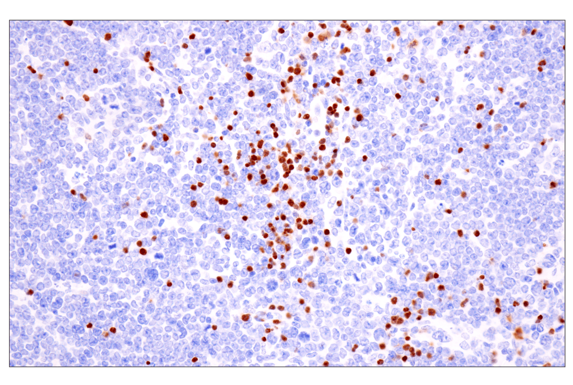 Immunohistochemistry Image 7: TCF1/TCF7 (E6O1K) Rabbit Monoclonal Antibody