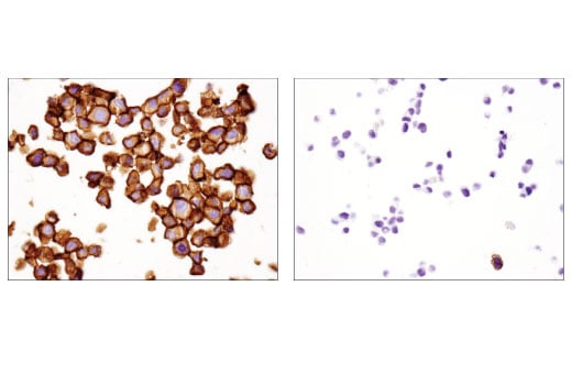 Immunohistochemistry Image 7: B7-H3 (D9M2L) Rabbit Monoclonal Antibody