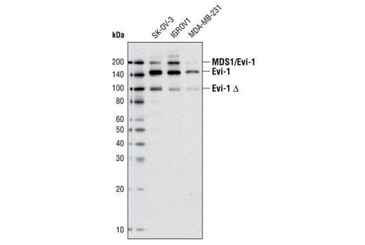 Western Blotting Image 1: Evi-1 (C50E12) Rabbit mAb