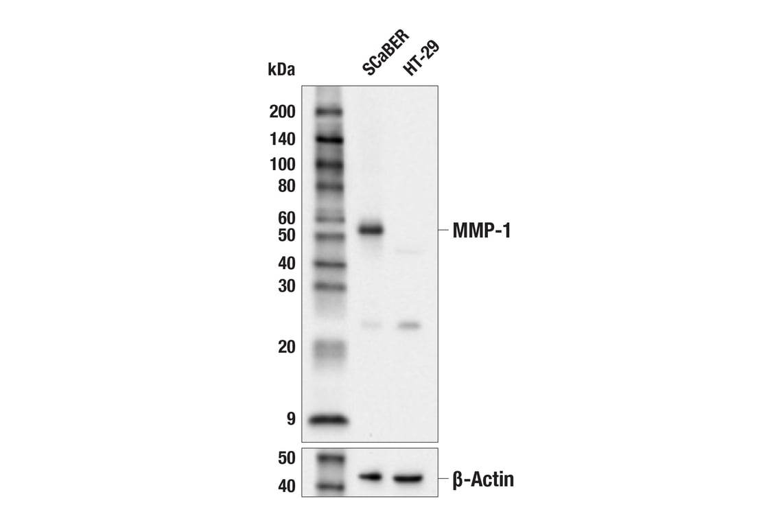 Western Blotting Image 1: MMP-1 (E8G4F) Rabbit mAb