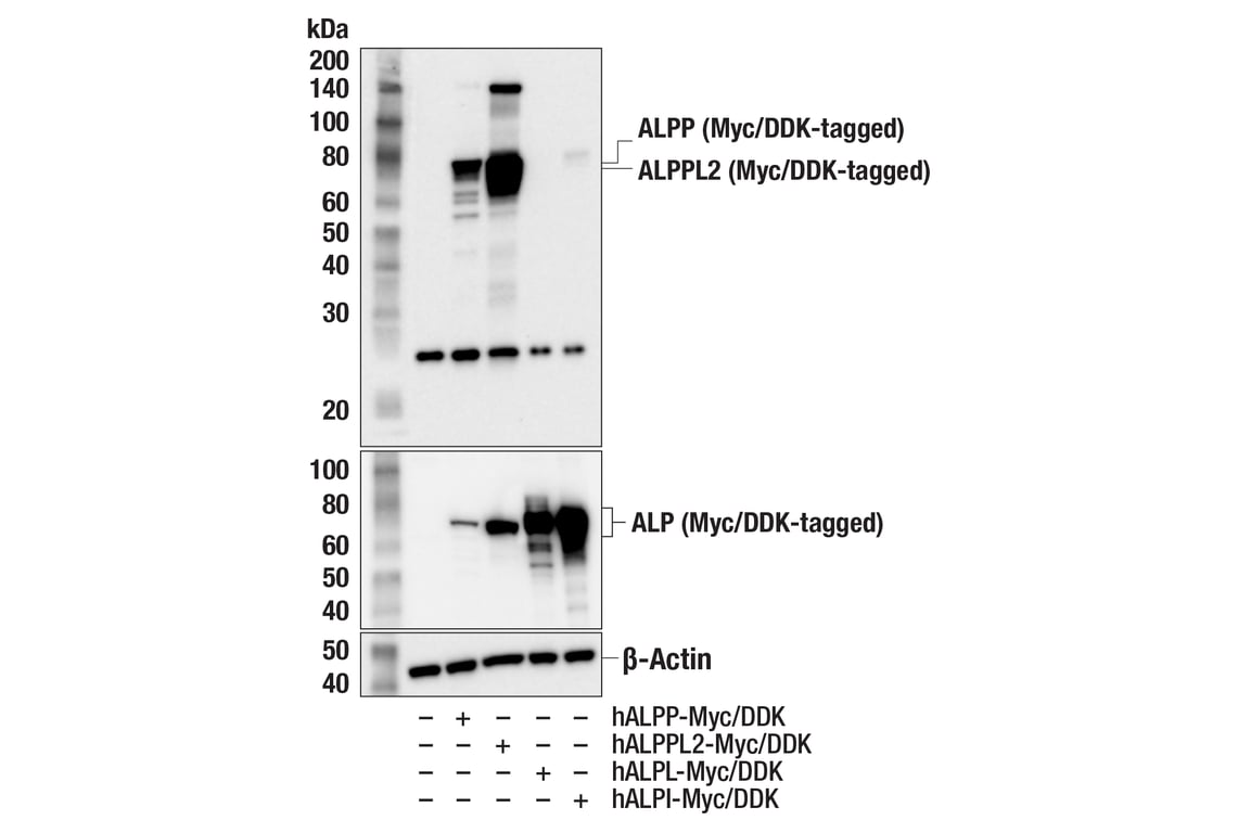 Western Blotting Image 2: ALPP/ALPPL2 (F1L4G) Rabbit Monoclonal Antibody