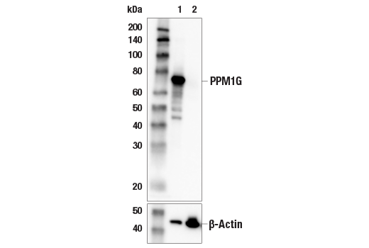 Western Blotting Image 2: PPM1G (E7J2F) Rabbit Monoclonal Antibody